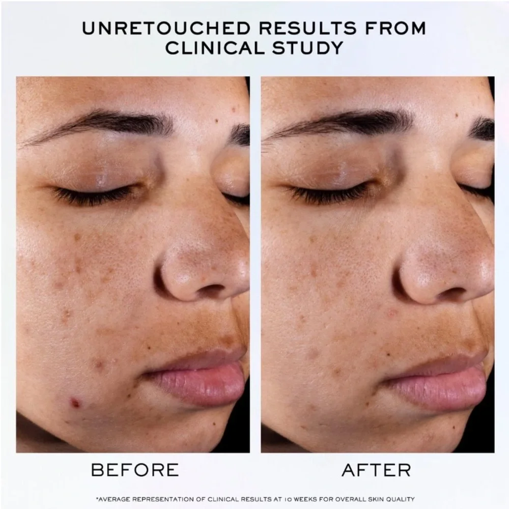 Lancôme Clarifique Brightening & Dark Spot Reducing Serum Mini